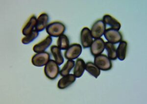 spores under microscope